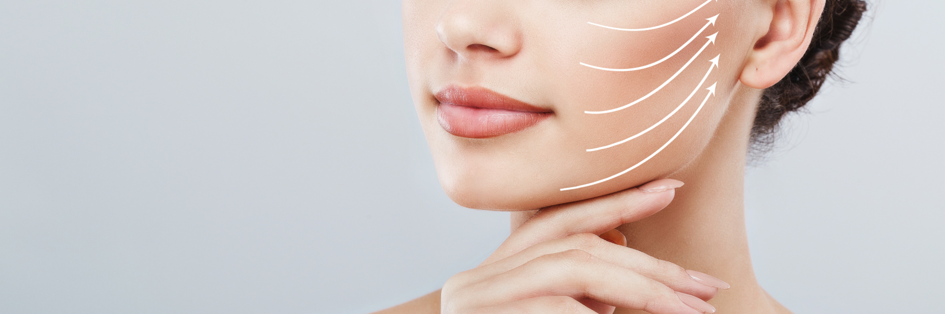 Thread chin lift with Aptos technique in MediEsté Clinic